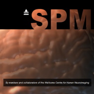 SPM